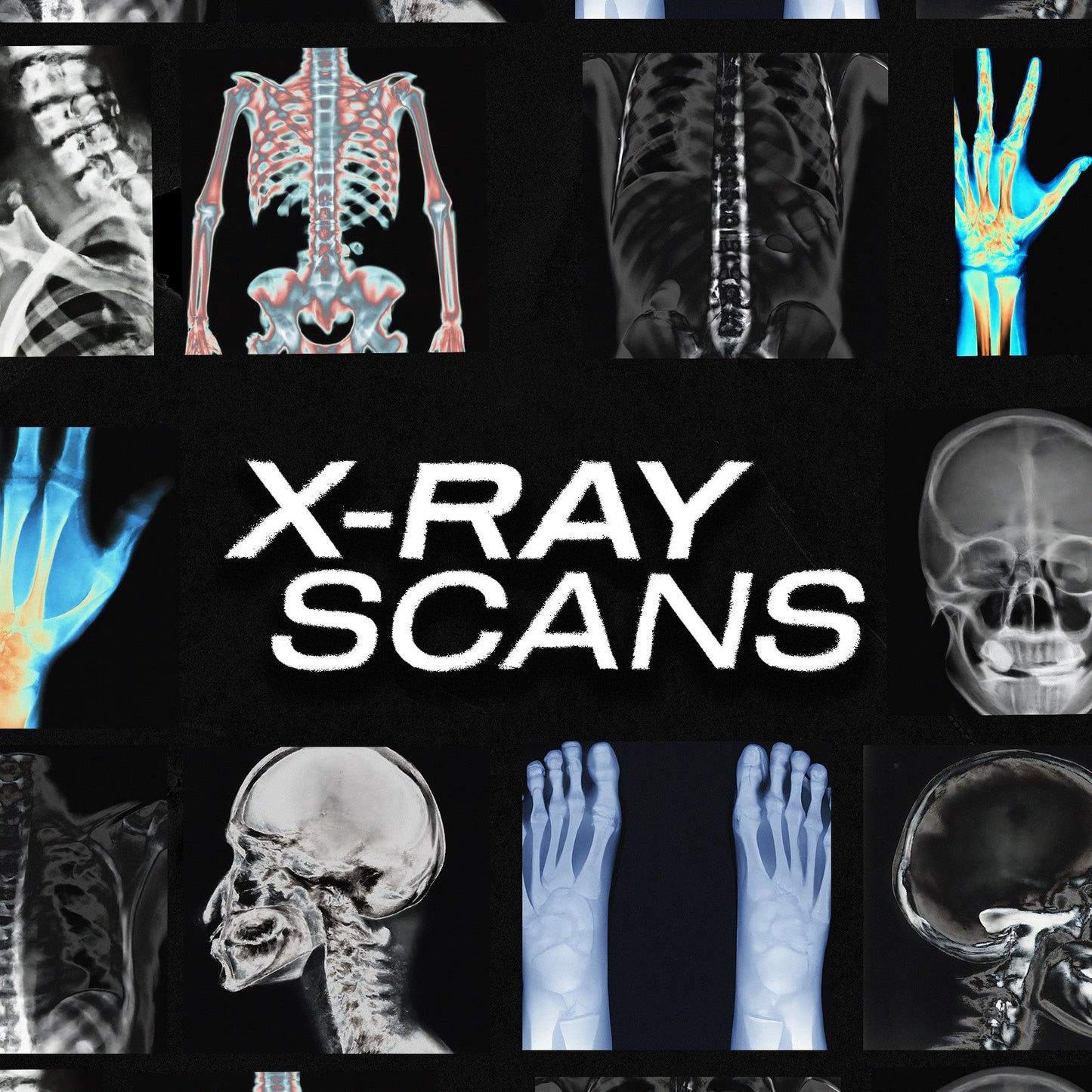 X-Ray Scans pack cover with skull, spine, ribcage, and hand X-ray imagery on black background