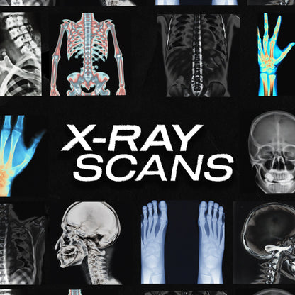 X-Ray Scans pack cover with skull, spine, ribcage, and hand X-ray imagery on black background