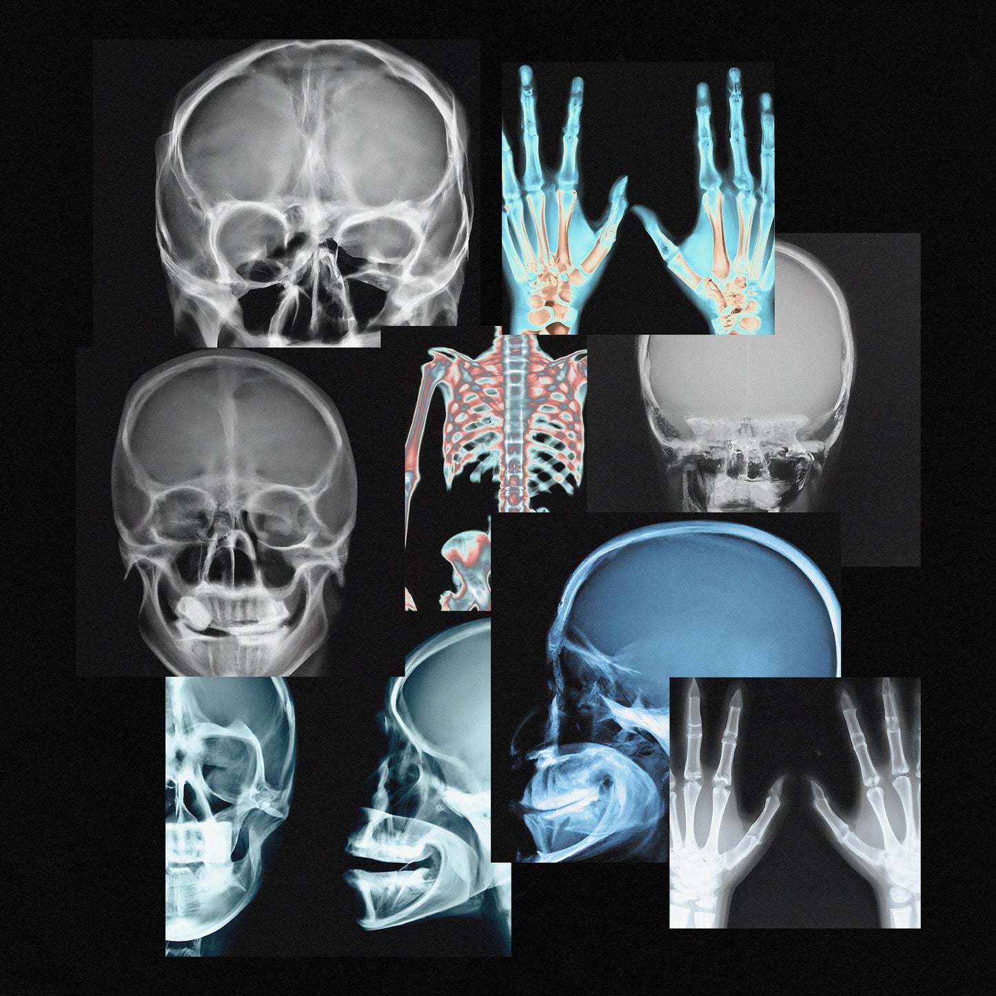 X-Ray Scans preview with layered skull X-rays, skeletal torso imagery, and hand scans